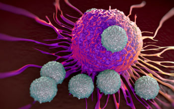 smart cell therapy to treat aggressive solid cancers