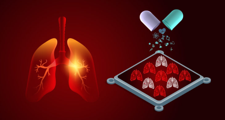 rapid no-chip test to predict patient responses with lung cancer