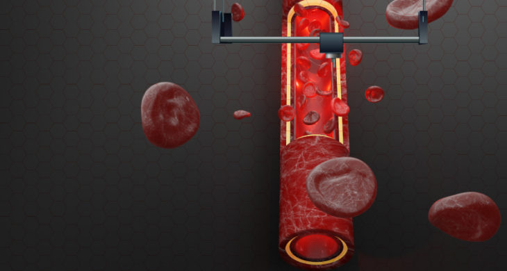 bioprinted blood vessels model human disease