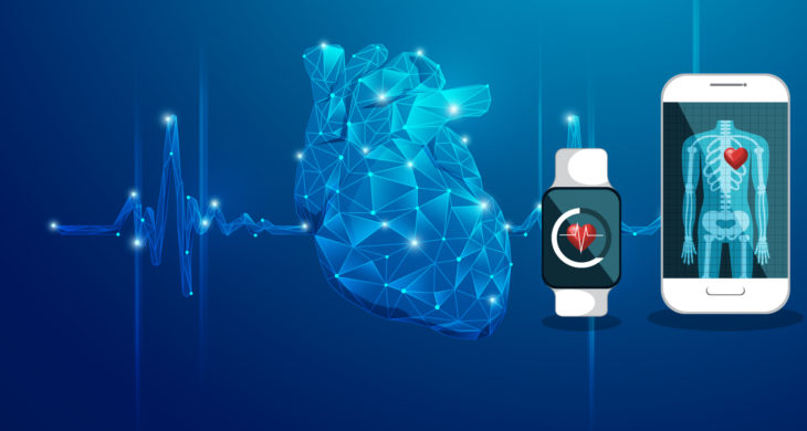 Smartwatch detecs atrial fibrillation