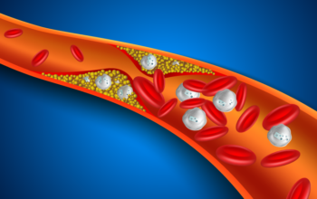 nanoparticles reduce plaques