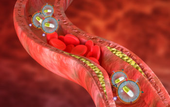 treating atherosclerosis with macrophage membrane coated nanoparticles