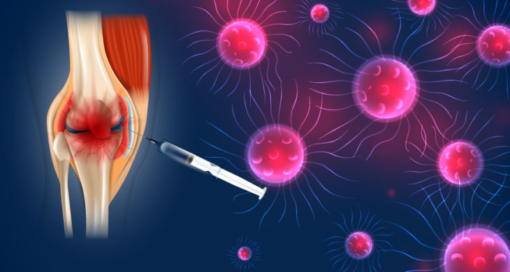 ligan-conjugate nanoparticle treat oseoarthritis