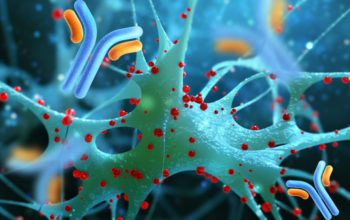 immunotherapy for Alzheimer's disease