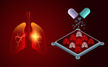 rapid no-chip test to predict patient responses with lung cancer