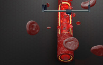 bioprinted blood vessels model human disease