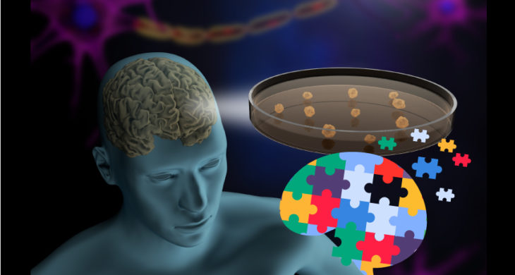 brain organoids for autism research